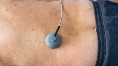 4K UHD footage of electro stimulation medical procedure with male senior patient 스톡 동영상 85638450