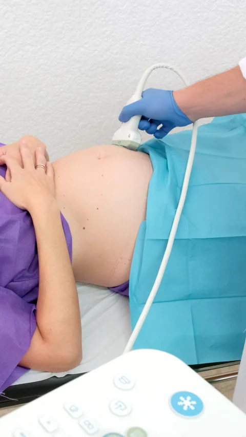 4K vertical video of gynecologist using ultrasound Stock Footage 282398996