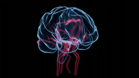 4K video of Circle of Willis Arteries in Xray Stock Footage 327904107