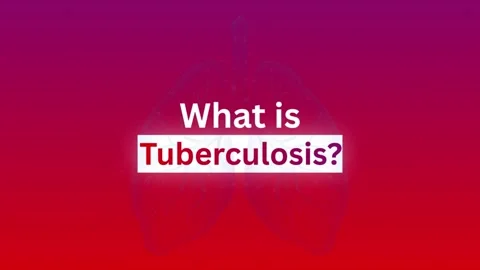 4K What is Tuberculosis Typography Motion Graphic Lungs Background Stock Footage 345755338