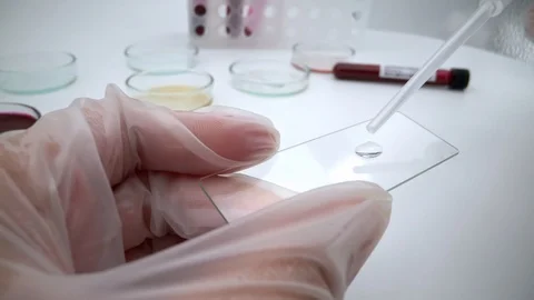 4K, Work lab testing for infectious coronavirus. COVID-19 pandemic outbreak-Dan Stock Footage 126403774