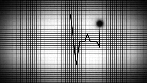 4k heartbeat on a red background and a split electrical board. ECG monitor Stock Footage 246356303