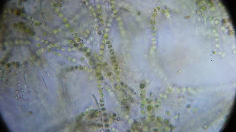 50 times magnification under the microscope Stock Footage 129420882