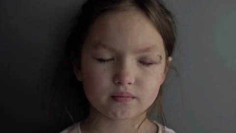 A 6-7 year old girl has a painful wound ... | Stock Video | Pond5