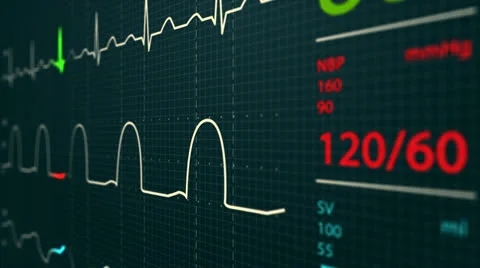 601 Electrocardiogram 003 C HD Stock Footage 26148612