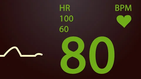 601 Electrocardiogram 003 A HD Stock Footage 26144331