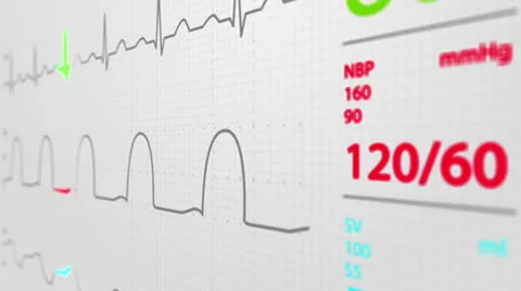 601 Electrocardiogram 004 HD Video stock 26149126