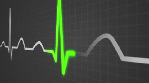 601 Electrocardiogram 005 B HD Stock Footage 26150397