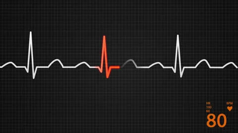 601 Electrocardiogram 005 A HD Stock Footage 26149680