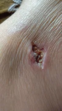 6th Days Stock Photos