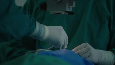 81 Close-Up of Surgeon Performing Eye Surgery in Operating Room - Medical Stock  Stock Footage 294917238