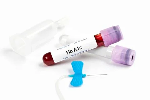 A1c Lab Blood Sample Stock Photos