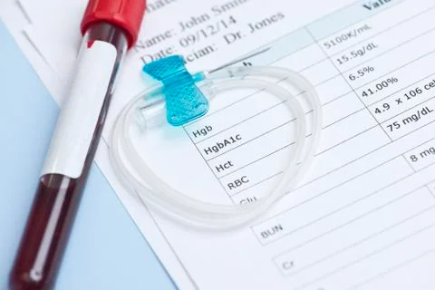 A1c test report Stock Photos