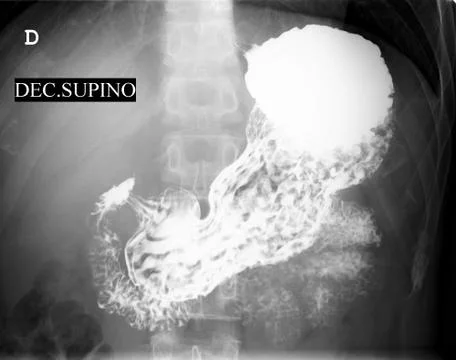 Abdomen x-ray Stock Photos