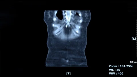 Abdominal-blue Stock Footage 112704873