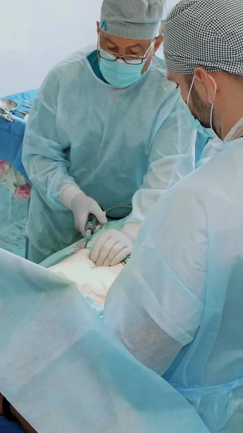 Abdominal liposuction, surgery in actual operating room. surgeon pumps out fat Stock-Footage 318682486