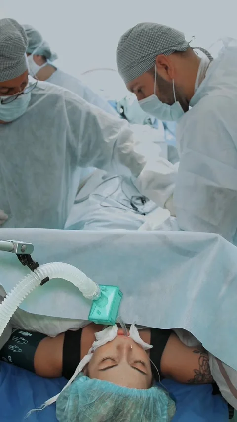Abdominal liposuction. surgery. the surgeon pumps out the fat through a special Stock-Footage 318239986