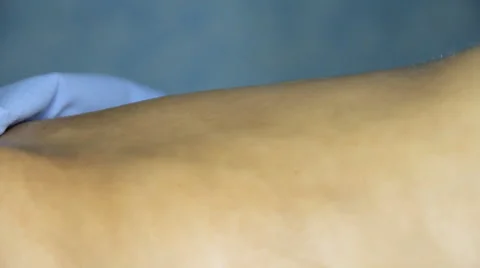 Аbdominal massage Stock Footage 64774265