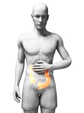 Abdominal pain, artwork Stock Illustration