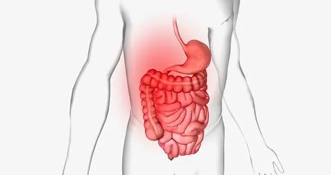 Abdominal pain is a common symptom that affects the digestive organs within.. Stock Illustration