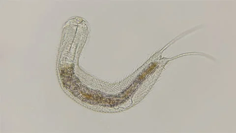 Abdominal worm Gastrotricha under the microscope Stock Footage 94840689