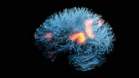 Abnormal brain activity, animation Video stock 178672228