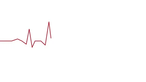 Abnormal ECG cardiogram animation with irregular heart rhythm footage Stock Footage 338187783