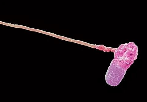 Abnormal human sperm cell, SEM Stock Photos