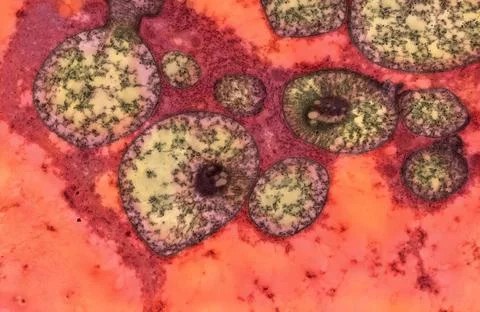  Abnormal mouse mitochondria The figure is an electron micrograph showing ... Stock Photos