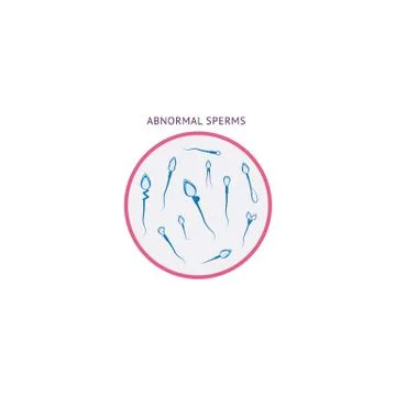 Abnormal spermatozoids morphology flat vector illustration isolated on Stock Illustration