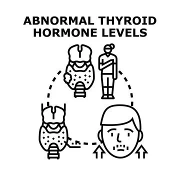 Abnormal thyroid hormone levels causing health problems Stock Illustration