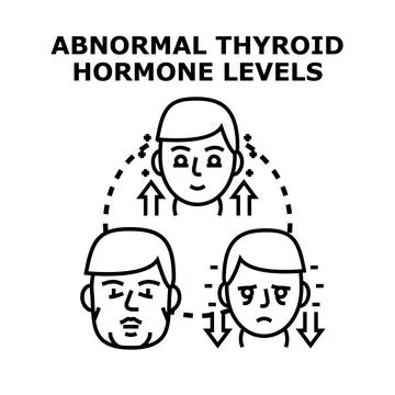Abnormal thyroid hormone levels in endocrine conditions concept Stock Illustration