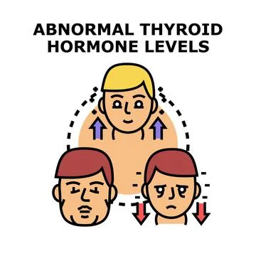 Abnormal thyroid hormone levels in endocrine conditions concept Stock Illustration