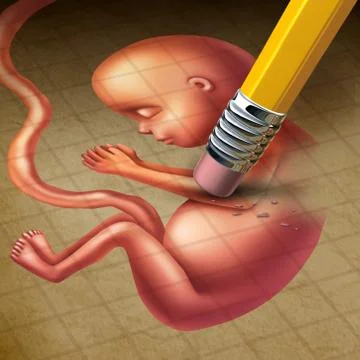 Abortion Stock Illustration