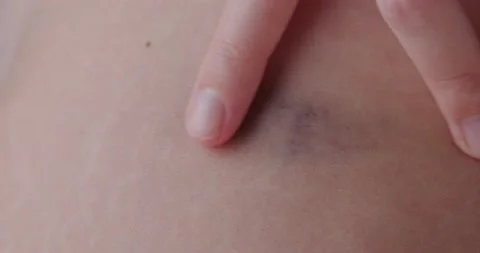 Abrasion Stock Footage 140498085