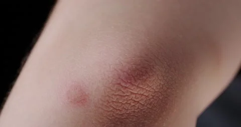 Abrasion Stock Footage 140498188
