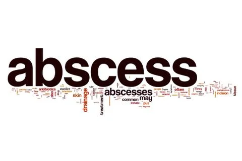 Abscess word cloud concept Stock Illustration