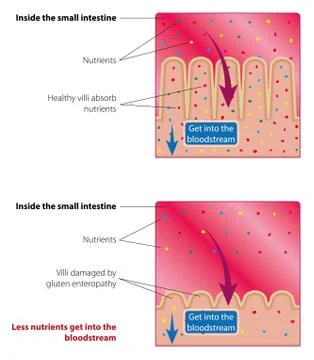 Absorption of nutrients in the small intestine Stock-Illustration