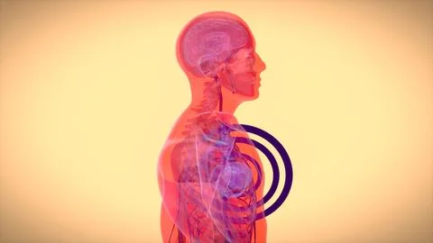 Abstract 3D illustration of a heart attack Stock Illustration