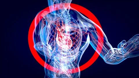 Abstract 3D illustration of a heart attack Stock Illustration