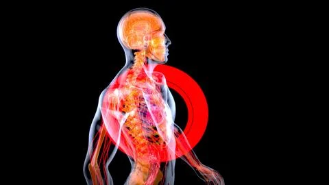 Abstract 3D illustration of a heart attack Stock Illustration
