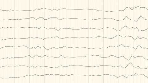 Abstract Background Animation - Brainfunction EEG 스톡 동영상 71198393