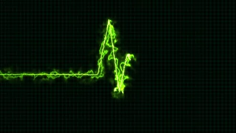Abstract background heartbeat line neon light heartbeat display screen medi.. Stock Footage 291946162