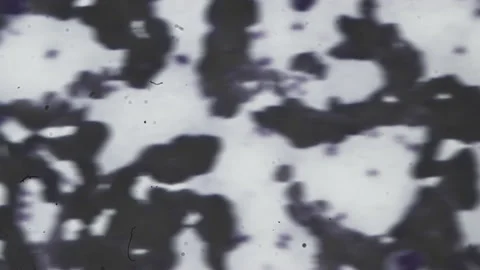 Abstract bacteria and microbes under the microscope. Fungus or mold is Stock Footage 159853080