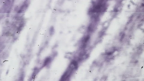 Abstract bacteria and microbes under the microscope. Fungus or mold is Stock Footage 159853743