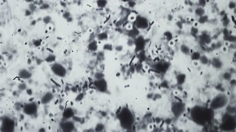 Abstract bacteria and microbes under the microscope. Fungus or mold is Stock Footage 160110661