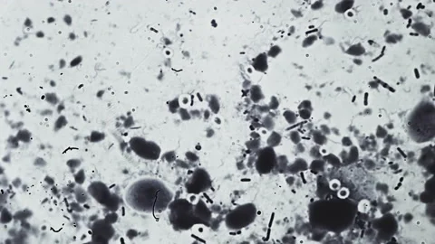 Abstract bacteria and microbes under the microscope. Fungus or mold is Stock Footage 160356304