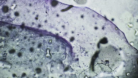 Abstract bacteria and microbes under the microscope. Fungus or mold is Stock-Footage 160410233