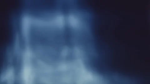 Abstract Blue Soft Light Bokeh Background Stock Footage 318581729