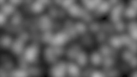 Abstract cellular patterns in motion during microscopic observation with so.. Stock Footage 340949793